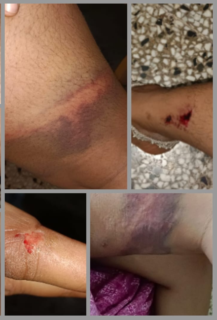 छत्तीसगढ़ सरकार में कानून व्यवस्था पुरी तरह से हुआ ध्वस्त,…………..नही रहा अपराधियों में पुलिस का खौफ,सरेआम हो रहा है गुंडागर्दी और मारपीट