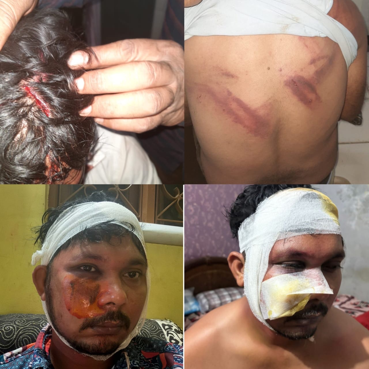 थाने में न्याय मांगना पड़ा महंगा!  शिकायत करने गए युवक को सिपाही ने पीटा, बहन को लेकर की अभद्रता – अब तक FIR तक नहीं