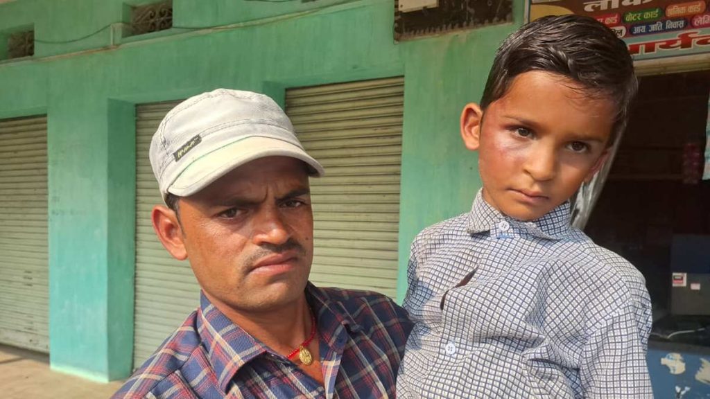 बाल सुरक्षा पर सवाल: गिनती गलत होने पर शिक्षक ने 7 वर्षीय छात्र को पीटा, आंख में खून, चेहरा सूज गया, पुलिस और शिक्षा विभाग ने शुरू की जांच 