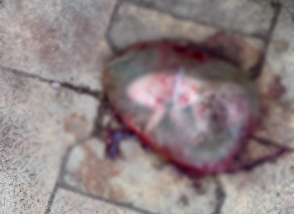 RAIPUR में एक बार फिर मानवता हुई शर्मसार! मेकाहारा अस्पताल के गेट पर मिला नवजात का शव, पॉलीथिन में भर फेंककर भागा आरोपी