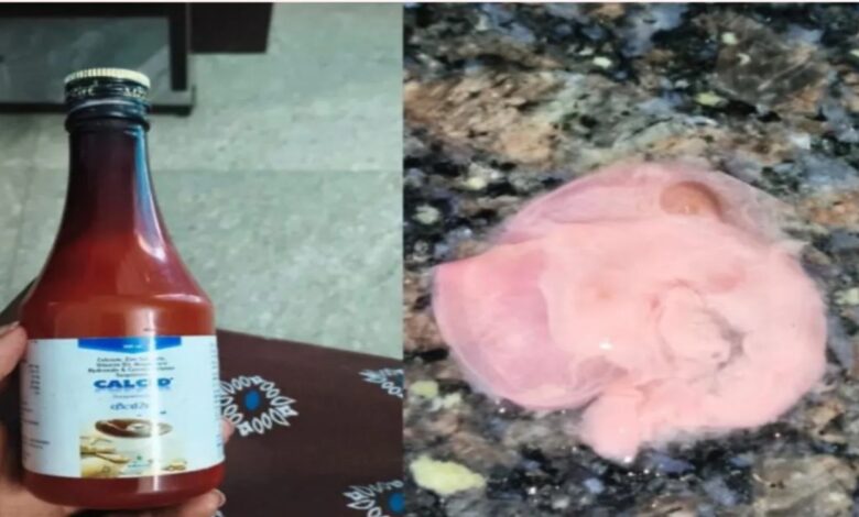 रायपुर में सरकारी अस्पताल में सनसनी: कैल्शियम सिरप की बोतल में मिला मांस का टुकड़ा