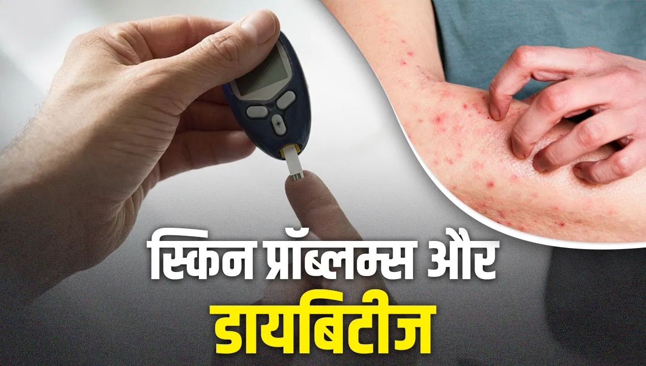 स्किन पर दिखने वाले ये लक्षण न करें नजरअंदाज, हो सकते हैं डायबिटीज के संकेत