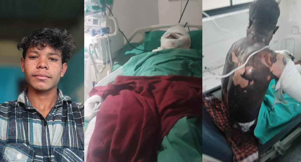 औद्योगिक हादसे ने उजाड़ा परिवार: 9 माह की मासूम के बाद पिता और युवक की भी मौत, निष्पक्ष जांच की उठी मांग