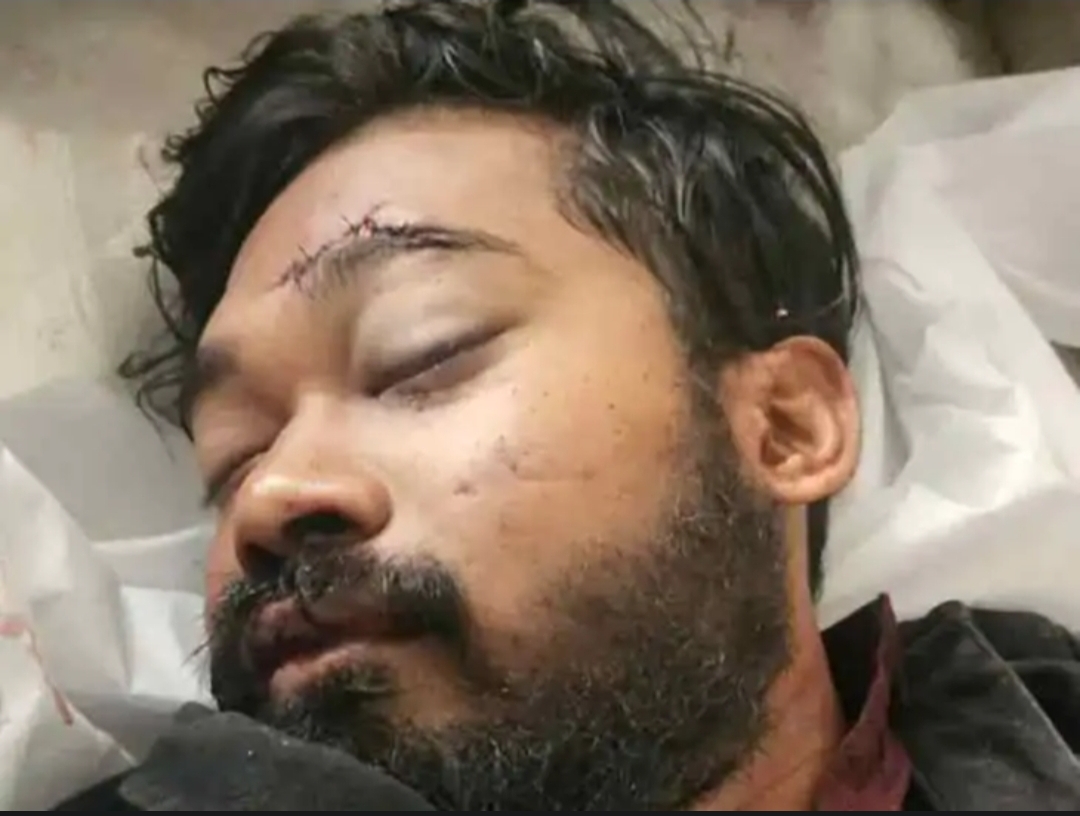 जिला न्यायालय के सामने ट्रक ने तहसीलदार के बेटे को रौंदा, लापरवाही पर ड्राइवर और ठेकेदार पर गैर-इरादतन हत्या का केस