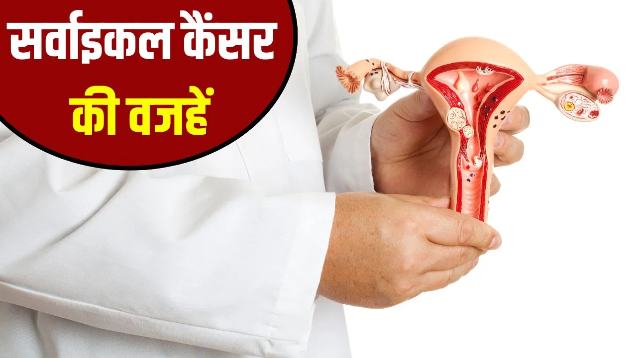 महिलाओं में सर्वाइकल कैंसर होने के बड़े कारण क्या हैं? कैसे करें बचाव