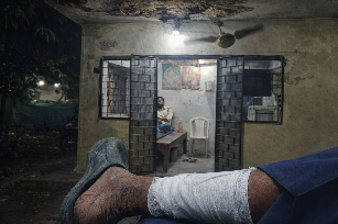 जज के बंगले में जानलेवा लापरवाही छत का प्लास्टर गिरने से होमगार्ड घायल पीडब्ल्यूडी के मेंटेनेंस पर उठे सवाल