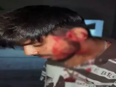 RAIPUR की पॉश सोसाइटी में चाकूबाजी! गाना बजाने को लेकर बवाल, प्रॉपर्टी डीलर के बेटे को चाकू मारकर फरार हुए आरोपी