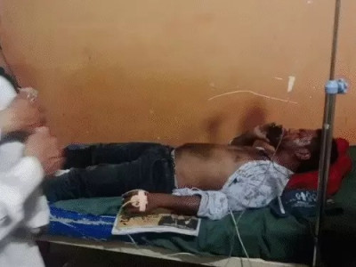 Bilaspur Shocker: AC कंप्रेसर ब्लास्ट से मची अफरा-तफरी, मरम्मत कर रहे दो भाई गंभीर रूप से घायल