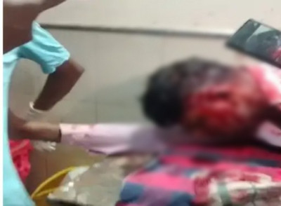 मामूली बहस बनी खूनी झड़प: रायपुर एयरपोर्ट के बाहर ऑटो चालक ने बोतल फोड़कर किया हमला, आरोपी गिरफ्तार, मचा हड़कंप