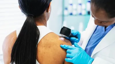 क्या गर्मियों में बढ़ जाता है स्किन कैंसर का खतरा? एक्सपर्ट से जानें