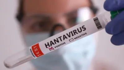 Hanta Virus Alert: इन लोगों को ज्यादा रहता है हंता वायरस का खतरा, एक्सपर्ट ने बताए बचाव के जरूरी तरीके