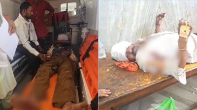 CG Bear Attack: तेंदूपत्ता सीजन में जंगल बना खतरा, 6 भालुओं के हमले में 2 ग्रामीण गंभीर, इलाके में दहशत