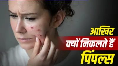 बारिश की उमस में क्यों बढ़ जाते हैं पिंपल्स? एक्सपर्ट ने बताया स्किन खराब होने का साइंस