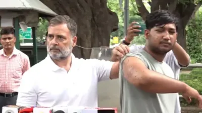 Rahul Gandhi PC: घायल छात्र को साथ लाकर राहुल गांधी का बड़ा आरोप, बोले- 'प्रदर्शनकारियों पर चली पैलेट गन'; सरकार ने किया खंडन