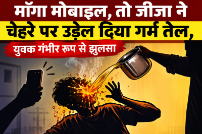 माँगा मोबाइल, तो जीजा ने चेहरे पर उड़ेल दिया गर्म तेल, युवक गंभीर रूप से झुलसा