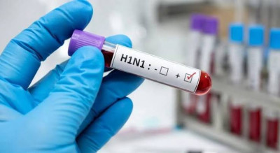 दिल्ली-NCR में H1N1 का बढ़ता कहर! दिल्ली में 2308 केस, नोएडा में 24 घंटे में 105 नए मरीज