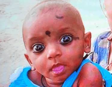 रिश्तों का डरावना चेहरा: चाचा ने 2 साल की भतीजी को जलते चूल्हे में फेंका, इलाज के दौरान मौत