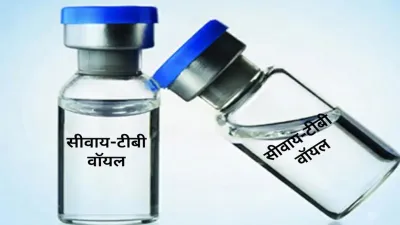Chhattisgarh TB News: एक तरफ TB मरीजों की जांच का दबाव, दूसरी तरफ एक्सपायरी की कगार पर करोड़ों का Cy-Tb स्टॉक