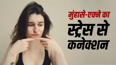 Stress and Acne: क्या ज्यादा तनाव लेने से चेहरे पर बढ़ जाते हैं पिंपल्स? जानें एक्ने और स्ट्रेस का साइंस