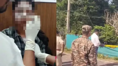 Balod Acid Attack: स्कार्फ ने बचाया युवती का चेहरा, दाहिनी आंख पर तेजाब का गंभीर असर; डॉक्टरों की निगरानी में इलाज