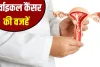 महिलाओं में सर्वाइकल कैंसर होने के बड़े कारण क्या हैं? कैसे करें बचाव