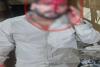 राजधानी में गैंगवार: पुरानी रंजिश और जेल कनेक्शन की भनक के बावजूद सोती रही पुलिस, सरेआम चले चाकू