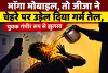 माँगा मोबाइल, तो जीजा ने चेहरे पर उड़ेल दिया गर्म तेल, युवक गंभीर रूप से झुलसा
