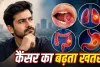 Cancer Cases in India: भारतीय पुरुषों में इन 4 कैंसर का खतरा ज्यादा, AIIMS डॉक्टर ने बताए प्रमुख कारण और चेतावनी संकेत