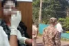 Balod Acid Attack: स्कार्फ ने बचाया युवती का चेहरा, दाहिनी आंख पर तेजाब का गंभीर असर; डॉक्टरों की निगरानी में इलाज