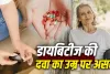 Metformin Anti-Aging: क्या डायबिटीज की दवा धीमी कर सकती है उम्र बढ़ने की प्रक्रिया? जानें रिसर्च
