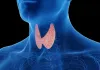 महिलाओं को थायरॉइड होने के बाद क्या चीजें नहीं खानी चाहिए?
