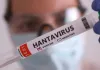 Hanta Virus Alert: इन लोगों को ज्यादा रहता है हंता वायरस का खतरा, एक्सपर्ट ने बताए बचाव के जरूरी तरीके