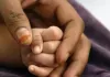 मामूली चोट, फिर एनेस्थीसिया... और चली गई 18 महीने के बच्चे की जान, डॉक्टर पर केस दर्ज