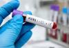 दिल्ली-NCR में H1N1 का बढ़ता कहर! दिल्ली में 2308 केस, नोएडा में 24 घंटे में 105 नए मरीज