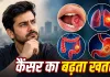Cancer Cases in India: भारतीय पुरुषों में इन 4 कैंसर का खतरा ज्यादा, AIIMS डॉक्टर ने बताए प्रमुख कारण और चेतावनी संकेत