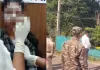 Balod Acid Attack: लाइब्रेरी से लौट रही 22 वर्षीय युवती पर तेजाब फेंकने का आरोप, हालत गंभीर; रायपुर रेफर