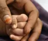 मामूली चोट, फिर एनेस्थीसिया... और चली गई 18 महीने के बच्चे की जान, डॉक्टर पर केस दर्ज