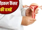 महिलाओं में सर्वाइकल कैंसर होने के बड़े कारण क्या हैं? कैसे करें बचाव