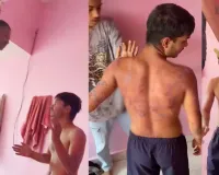 Raipur Rehab Horror: नशामुक्ति के नाम पर क्रूरता! युवक की बेरहमी से पिटाई, वीडियो ने खोली सच्चाई