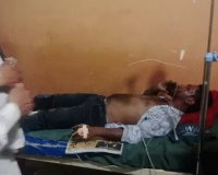 Bilaspur Shocker: AC कंप्रेसर ब्लास्ट से मची अफरा-तफरी, मरम्मत कर रहे दो भाई गंभीर रूप से घायल