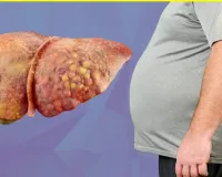 ग्लोबल लेवल पर तेजी से बढ़ रही लीवर की समस्या, लैंसेट रिपोर्ट का दावा- 2050 में हो जाएंगे 2 अरब लोग पीड़ित