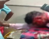 मामूली बहस बनी खूनी झड़प: रायपुर एयरपोर्ट के बाहर ऑटो चालक ने बोतल फोड़कर किया हमला, आरोपी गिरफ्तार, मचा हड़कंप