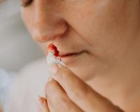 गर्मियों में नाक से खून आ गया है तो तुरंत क्या करें, ये क्यों होता है