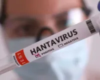 Hanta Virus Alert: इन लोगों को ज्यादा रहता है हंता वायरस का खतरा, एक्सपर्ट ने बताए बचाव के जरूरी तरीके