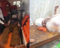 CG Bear Attack: तेंदूपत्ता सीजन में जंगल बना खतरा, 6 भालुओं के हमले में 2 ग्रामीण गंभीर, इलाके में दहशत