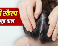 Healthy Scalp Care Tips: बालों की नहीं, पहले स्कैल्प की करें देखभाल, तभी मिलेगी मजबूत और घने बालों की ग्रोथ
