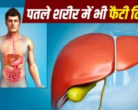 सिर्फ मोटे ही नहीं, दुबले लोग भी हो सकते हैं फैटी लिवर के शिकार! जानें कारण, लक्षण और बचाव