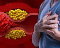 High Cholesterol क्यों बढ़ता है? रोज की ये गलत आदतें बना सकती हैं हार्ट डिजीज का कारण, जानें एक्सपर्ट की सलाह