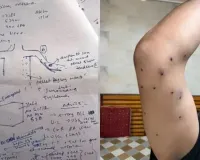 बड़ा खुलासा! संसद मार्च में पैलेट गन चलाने वाले RAF जवान की पहचान, CRPF जांच में सामने आई पूरी कहानी