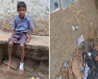 स्कूल बना शराबियों का अड्डा! टूटी शराब की बोतल से घायल हुआ मासूम, ग्रामीणों में आक्रोश; प्रिंसिपल को जारी होगा नोटिस 